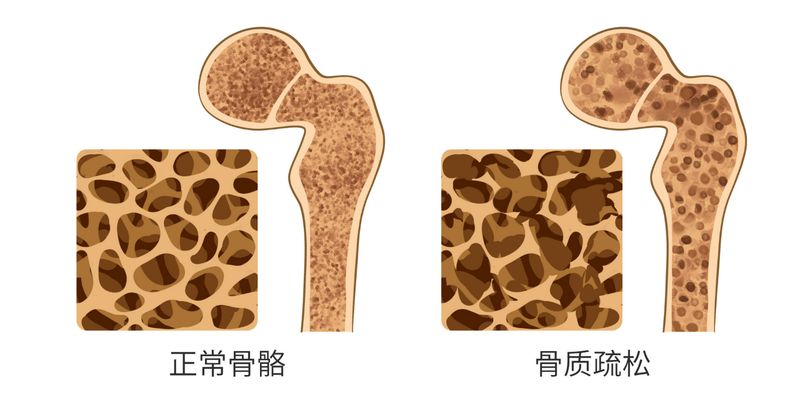 喝茶会导致钙流失 是不是谣言？